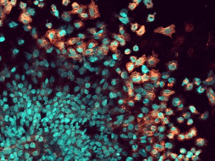 migrating cells