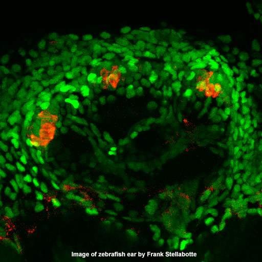 fluorescent image