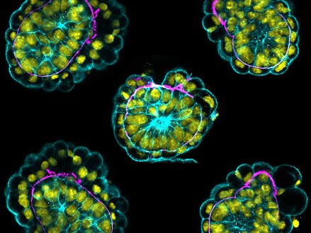 embryos at implantation