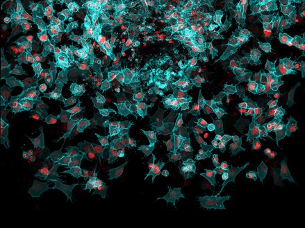 neural crest explant