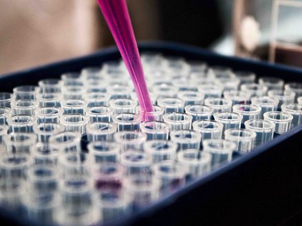 cell culture