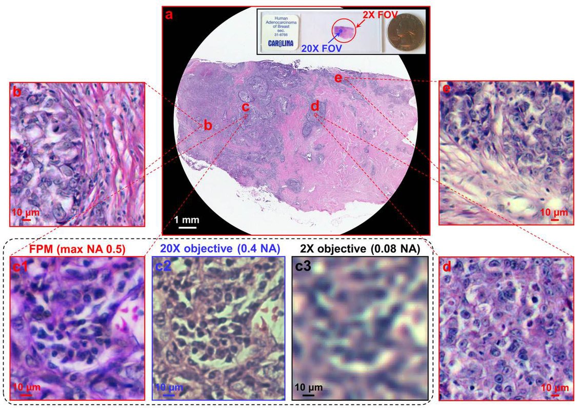 Fourier_Ptychography_digital_pathology.jpg