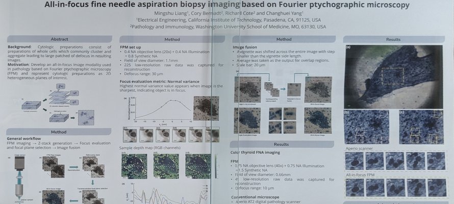 Image of All-in-focus fine needle aspiration biopsy imaging based on Fourier ptychographic microscopy research paper
