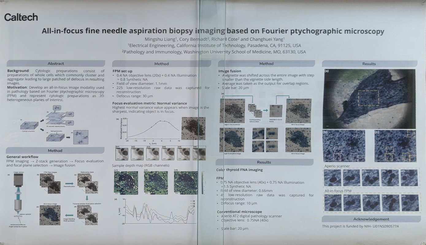 Image of All-in-focus fine needle aspiration biopsy imaging based on Fourier ptychographic microscopy research paper