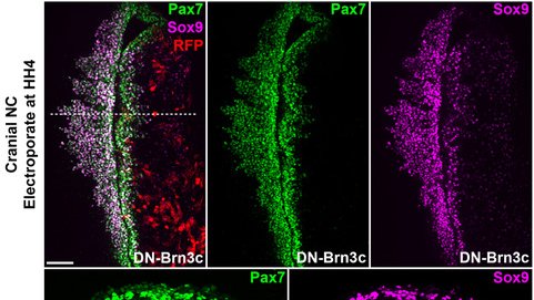 Expression of DN-Brn3c in neural crest cells