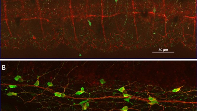 Neural crest in zebrafish gut