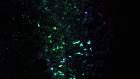 migrating neural crest cells