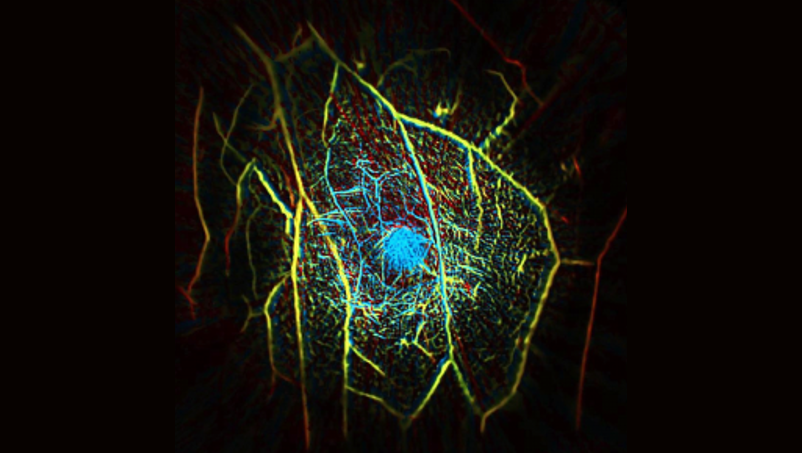 Depth-encoded angiogram of a healthy human breast acquired using Photoacoustic Computed Tomography (PACT)