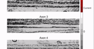 Myelinated_axons_firing