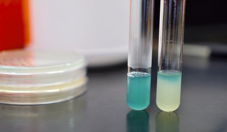 Cell cultures expressing different concentrations of phenazine