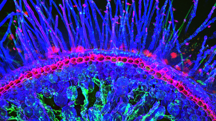 research image