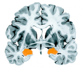 Amygdala