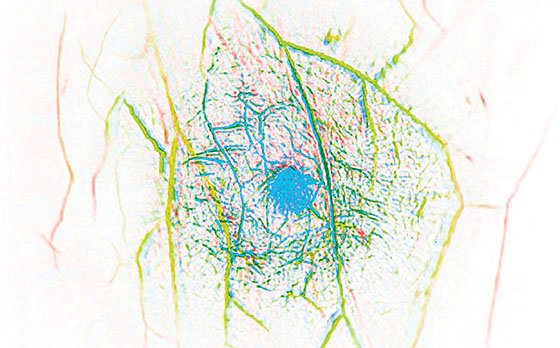 breast in vivo