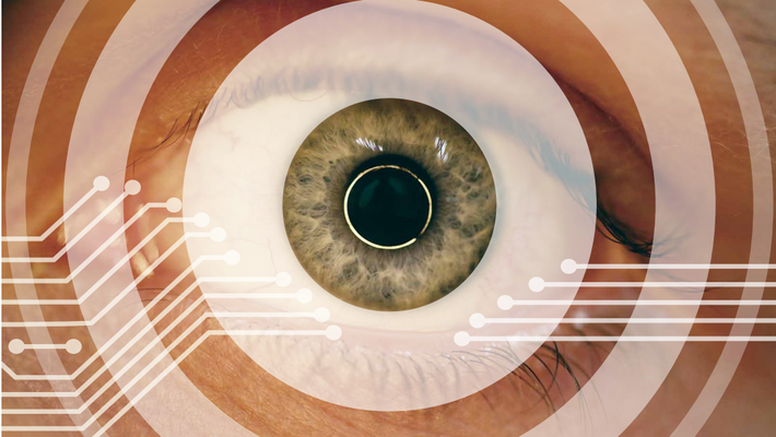 Eye