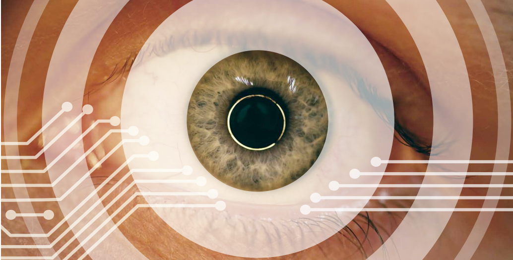 Eye