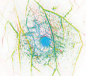 breast in vivo
