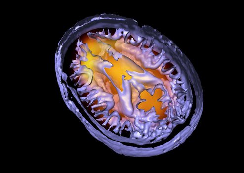 Replace this default