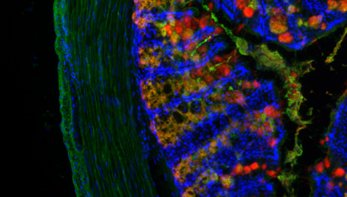 microbiome
