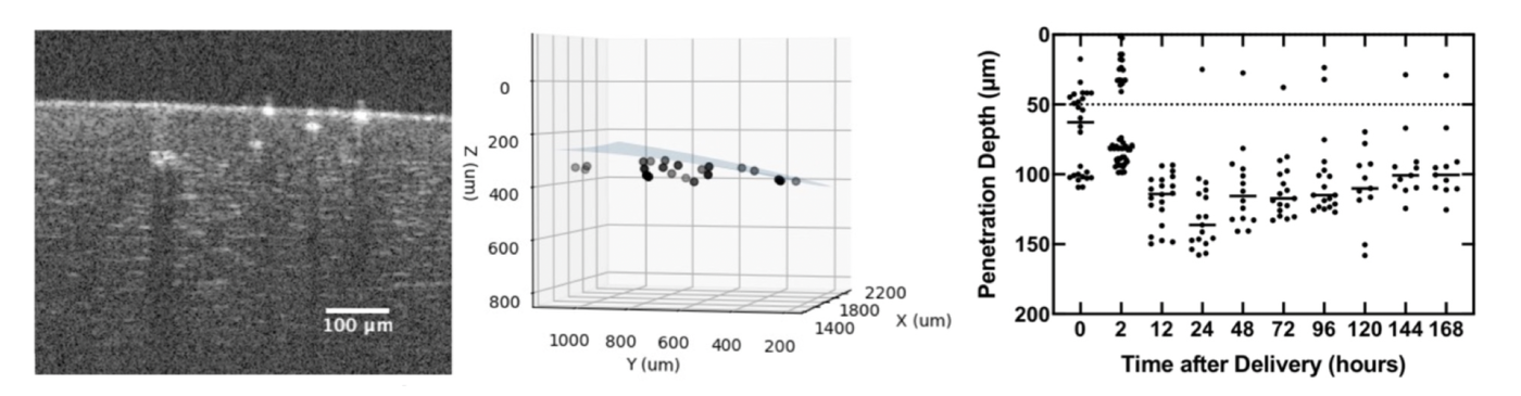 Fig.1