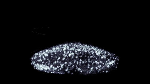 Priya biofilm