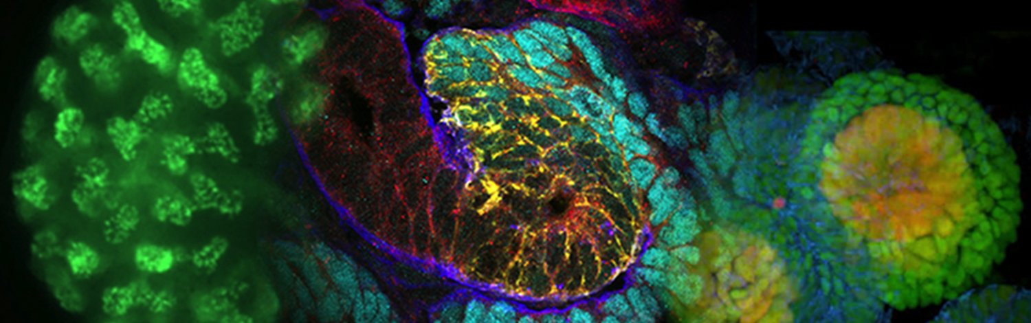 McMahon Lab banner featuring kidney images