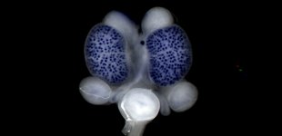 In situ staining of Lhx1 on an embryonic day 15.5 urogenital system (Image/Lisa Rutledge)