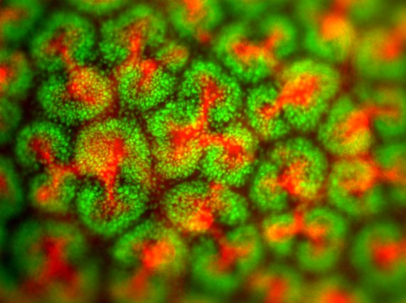 Embryonic kidney