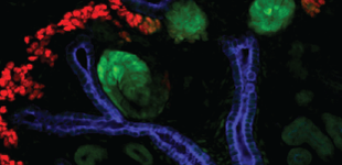 Embryonic kidney