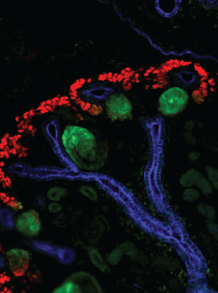 Embryonic kidney