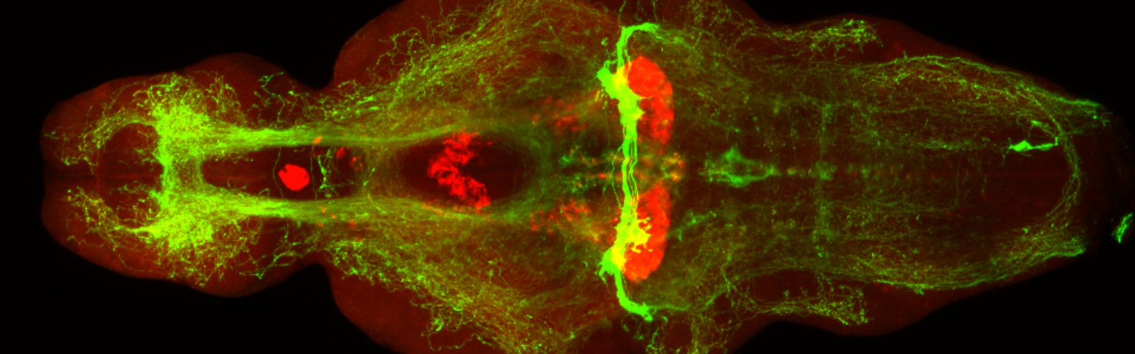 tph2:eNTR-GFP 5HT Ab