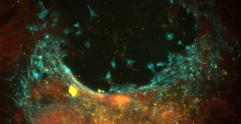 Image from Bronner lab