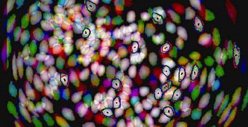 Neurons in mouse brain over 3 days