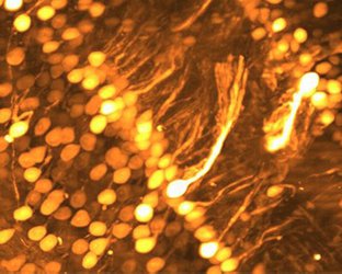 image from Gradinaru lab