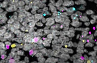 Cells, and tissue under a microscope