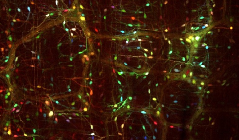 Genes for three fluorescent proteins were delivered by viral vectors into cells in the gastrointestinal nervous system. This technology can be used for labeling and imaging cells, as seen here, or to deliver genes that could ameliorate diseases.