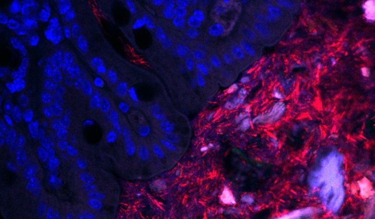 Bacteroides fragilis (red) and the epithelial surface (blue) of a mouse colon. Note bacteria in the center of the gut lumen and deep within colonic crypts.