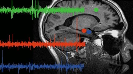 Brain scan image with colored brain wave oscillations