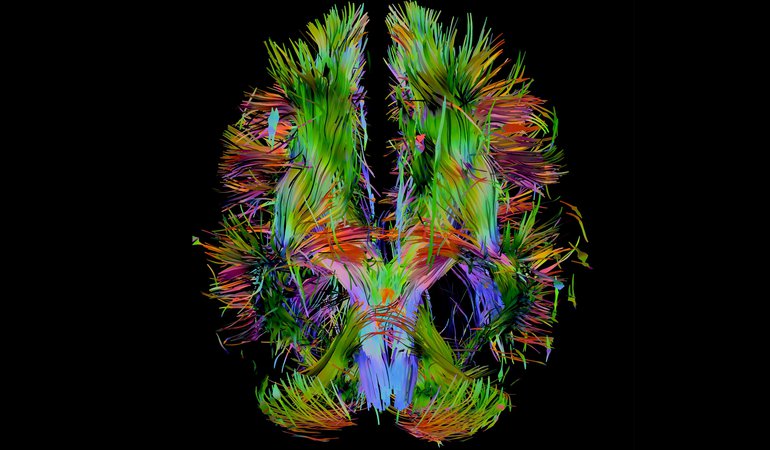 Colorful brain