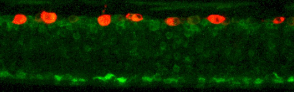 A larval zebrafish whose spinal cord