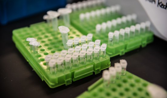lab assay