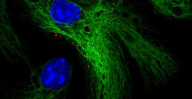 Neural Stem Cells