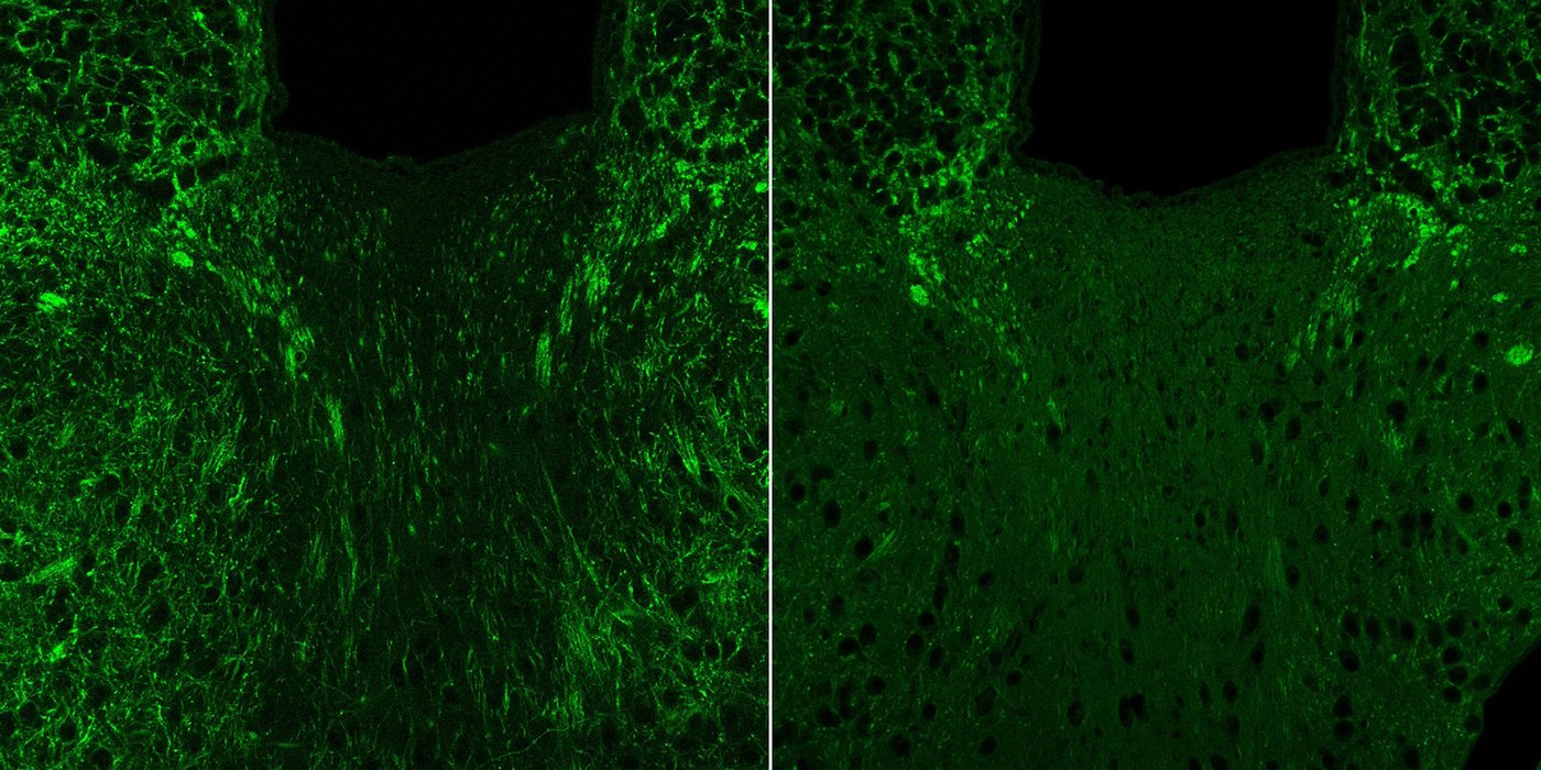 Left: Many bright green dots like a sky full of stars. Right: significantly fewer bright green dots.