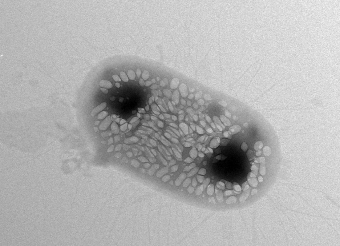 A transmission electron micrograph (TEM) image.