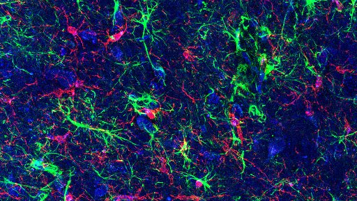 microglia