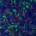 microglia