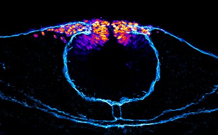 A false-colored image of neural crest cells unable to migrate