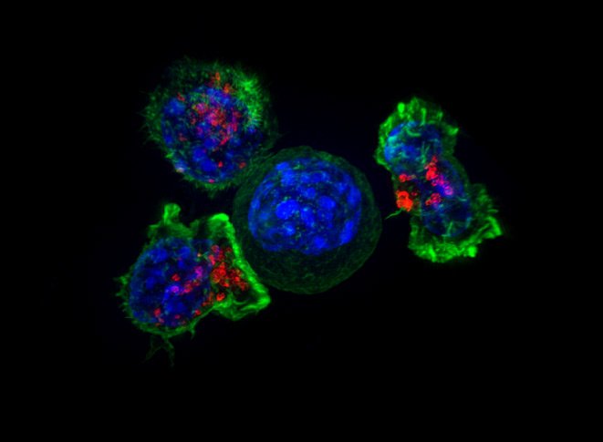 T cells surround a cancer cell