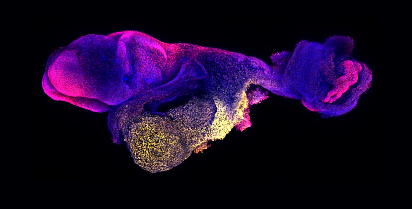 An oblong shape stained in purple and pink swirled together