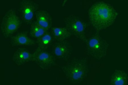Green and blue fluorescent dots.