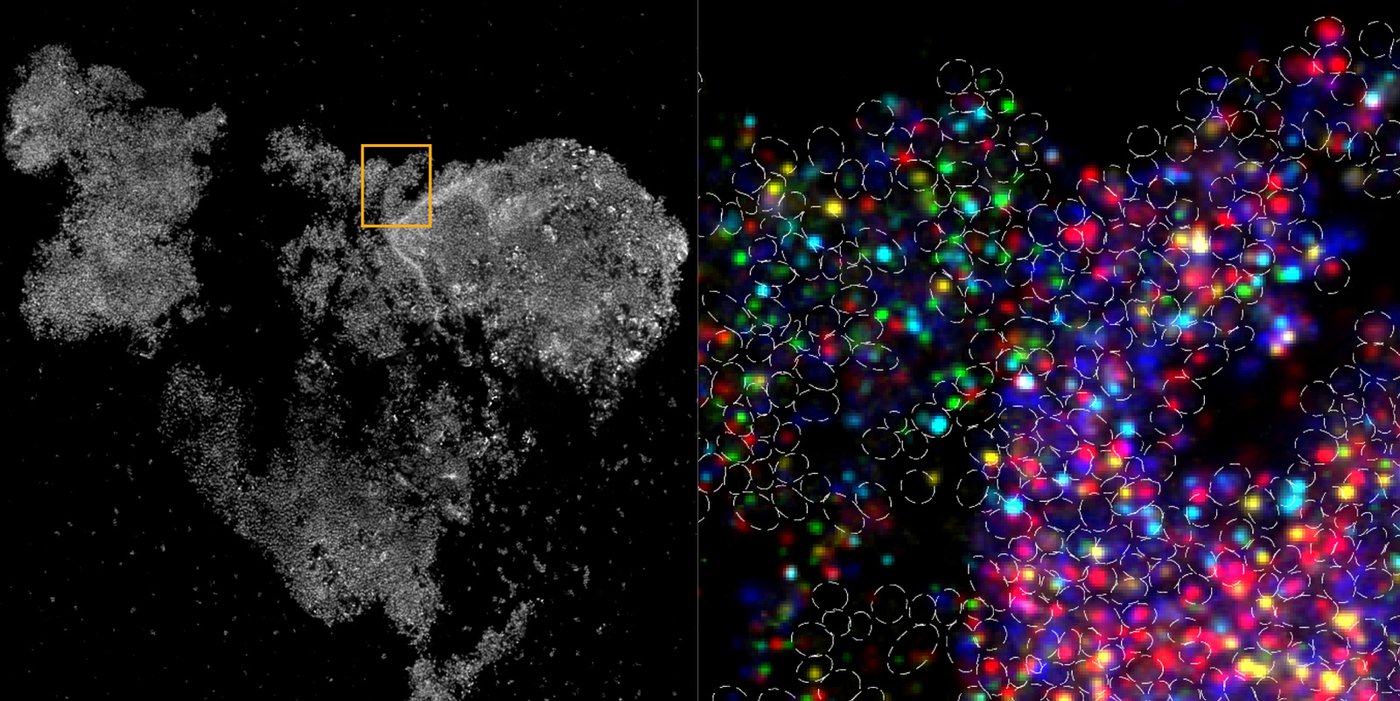 A black and white image of a group of cells, next to a close up with vivid fluorescent colors